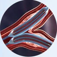 OEM PTCA Balloon Angioplasty